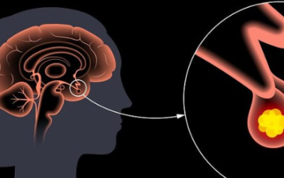 The Intriguing Link Between Aging, Inflammation, and Cancer